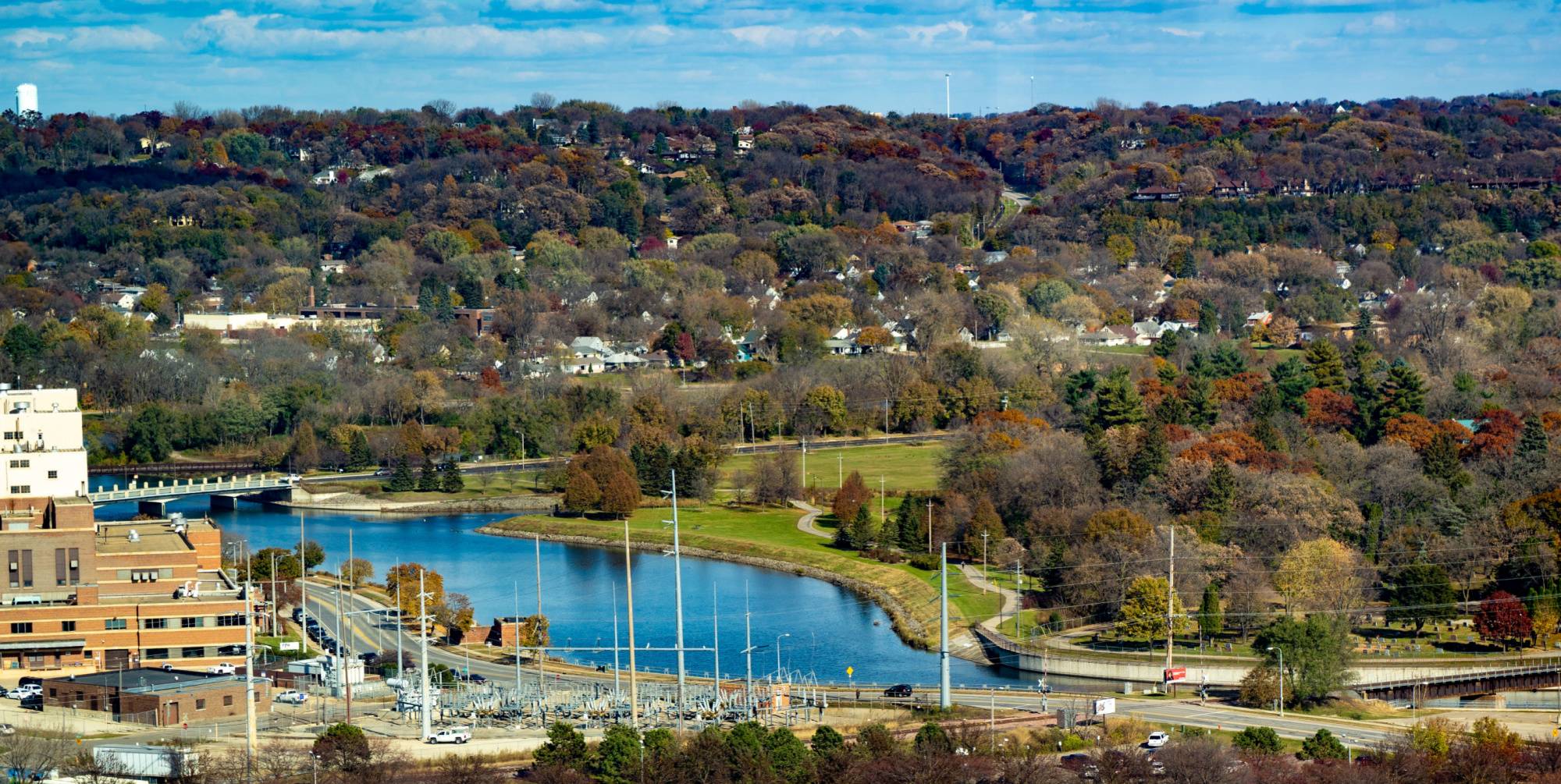 Endodontics Rochester MN, Endodontist